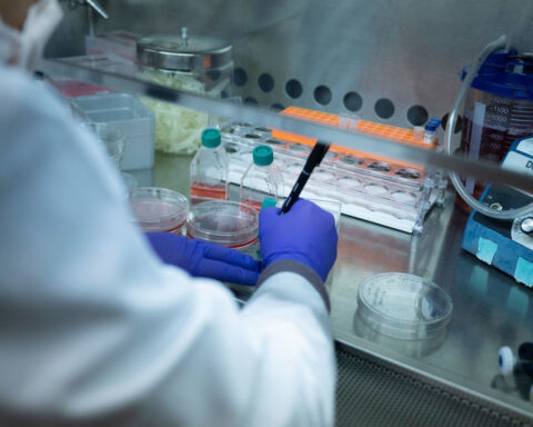 Critical health and science research is on the chopping block as Trump actions trigger shutdowns and confusion