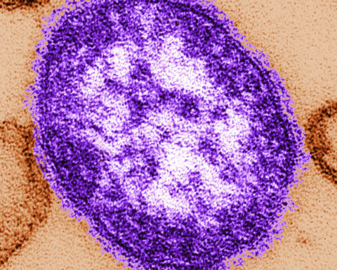 The measles situation worldwide: Fewer vaccinations and more outbreaks