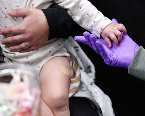 CDC says it’s on the ground in Texas as measles outbreak grows to 159 cases