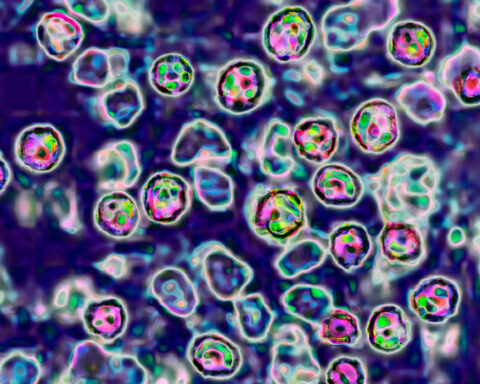 New Mexico health officials investigate cause of death in resident who tested positive for measles