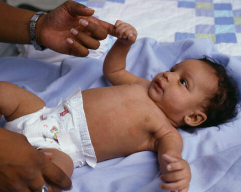 Whooping cough is making a comeback, but the vaccine provides powerful protection