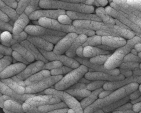 New salmonella outbreak is linked to backyard poultry, CDC says