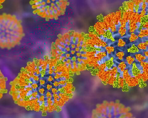 Measles could again become widespread as cases surge worldwide