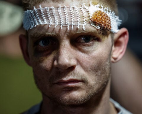 Wounded Ukrainian soldiers ask: What ceasefire?