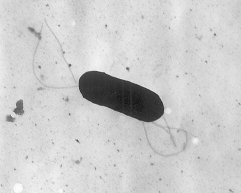 At least 10 people sickened in US listeria outbreak linked to prepared foods