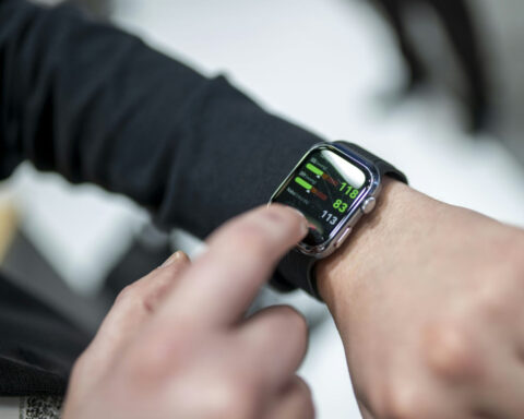 Smartwatches promise all kinds of quality-of-life improvements − here are 5 things users should keep in mind