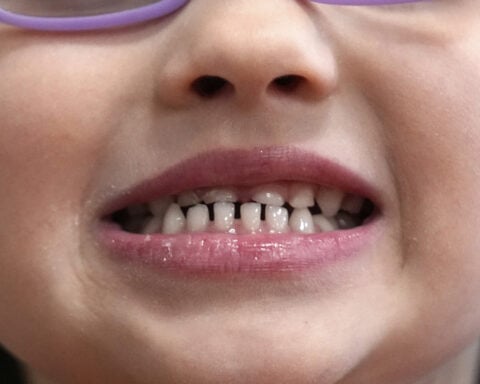 FDA and RFK Jr. aim to remove ingestible fluoride products used to protect kids' teeth