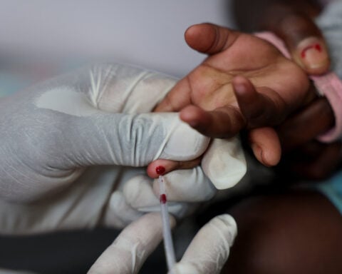 South Africa has no plan to replace US HIV funds yet, minister says