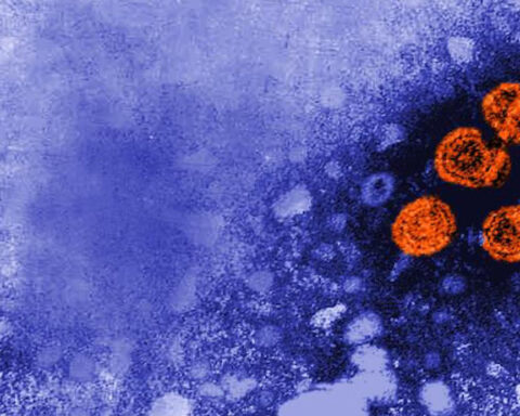 There is a hepatitis A outbreak in LA County. Why you need to know