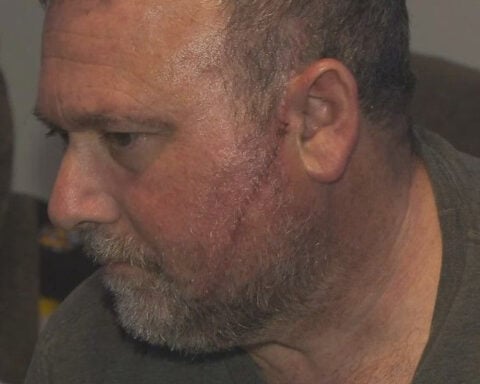 Father's face slashed outside hospital in random attack