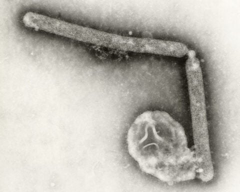 Brazil confirms its first bird flu outbreak in a commercial poultry farm