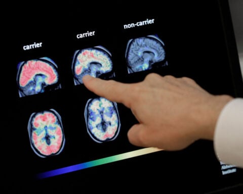 FDA greenlights first blood test to help diagnose Alzheimer’s disease in the US
