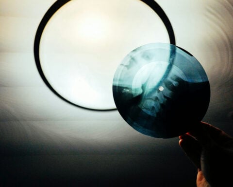 When Elvis and Ella were pressed onto X-rays – the subversive legacy of Soviet ‘bone music’