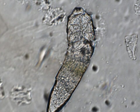 While you sleep, these bugs throw a party on your face