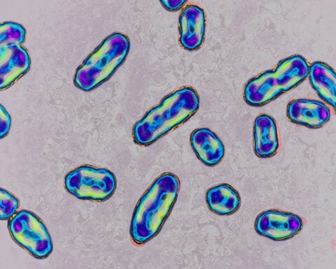 One of the world’s most notorious pathogens has survived for centuries. Scientists say they now know why