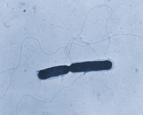 Deadly listeria outbreak linked to chicken alfredo fettucine sold at Kroger and Walmart
