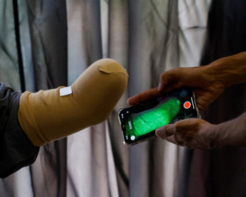 From Karachi to Gaza: Pakistani startup ships prosthetics to child war survivors