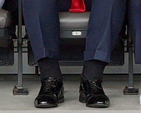 President Trump diagnosed with chronic venous insufficiency