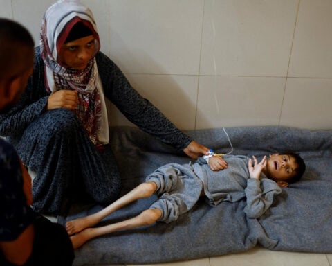 Gaza running out of specialised food to save malnourished children