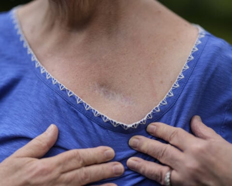 NIH cuts spotlight a hidden crisis facing patients with experimental brain implants
