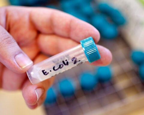 Florida reports 21 cases of E.coli infections linked to raw milk