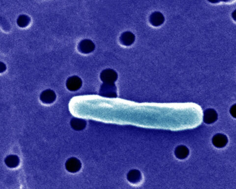 Nearly two dozen people in Florida are ill after drinking raw milk from the same farm