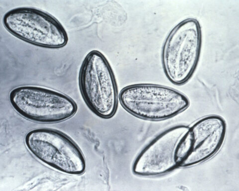 Do you need to cleanse your body of parasites? A doctor explains the social media fad