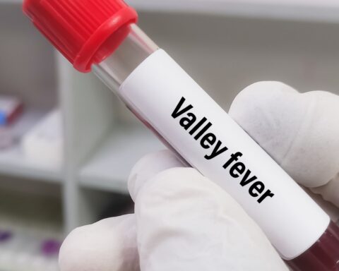 Valley fever surge shocks Riverside — is climate change to blame?