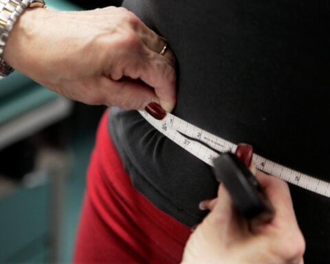 Obesity remains high in the US, but more states are showing progress, a new report finds