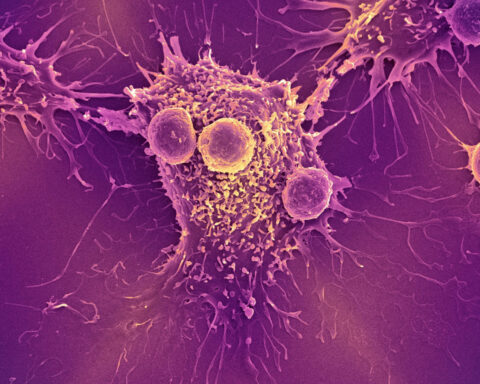 COVID-19 mRNA vaccines could unlock the next revolution in cancer treatment – new research