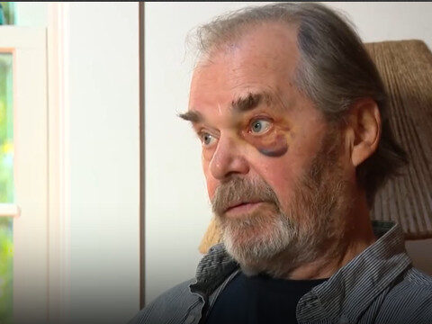 Massachusetts man accused of repeatedly punching man, 77, in face at Cape Cod 'No Kings' rally