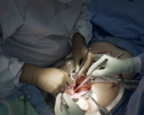 First clinical trial of pig kidney transplants gets underway