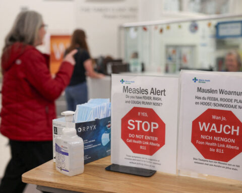 Canada loses its measles elimination status amid large outbreak