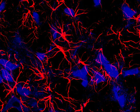Star-shaped cells make a molecule that can ‘rewire’ the brains of mice with Down syndrome – understanding how could lead to new treatments