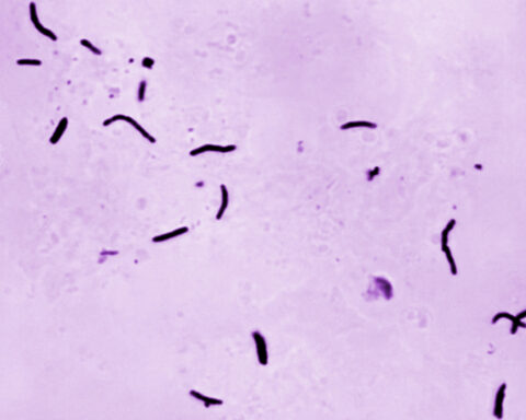 Global tuberculosis diagnoses rise to a record, but deaths fall, WHO reports