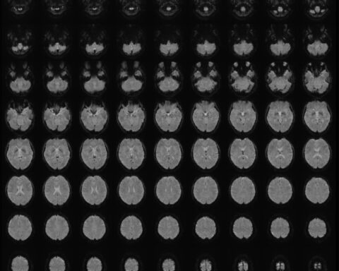 Scientist turns people’s mental images into text using ‘mind-captioning’ technology