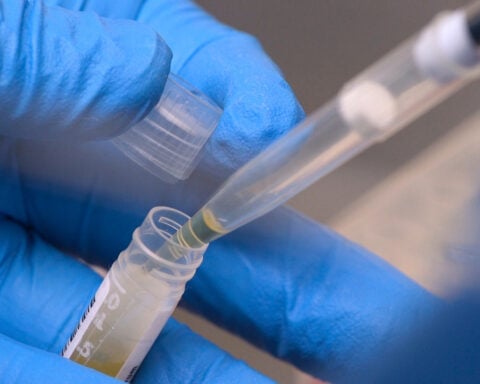 NIH funding cuts have affected over 74,000 people enrolled in experiments, a new report says