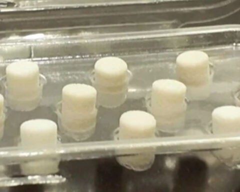 Coral from the sea is being used in some knee surgeries in NYC. Here's how, and why.