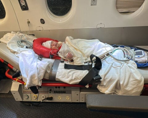 Investigators race to find the cause of botulism contamination in ByHeart infant formula