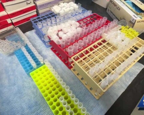 University of Vermont study finds new way to detect dementia before symptoms start