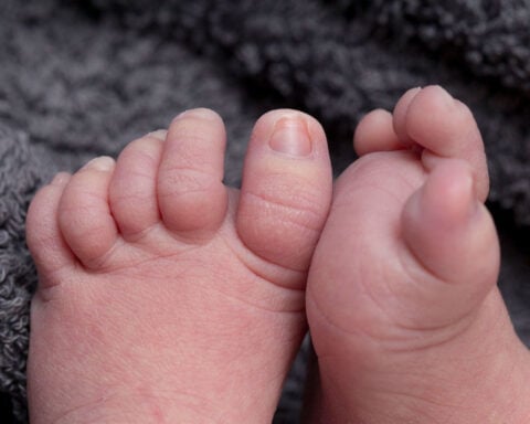 US stillbirth rate improved last year, but progress is slow