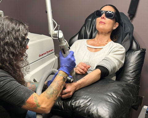 If you want that tattoo erased it's going to hurt and it's going to cost you