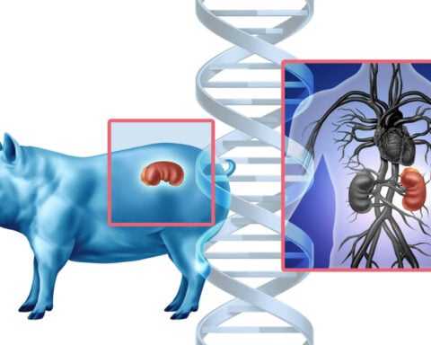 Putting pig organs in people is OK in the US, but growing human organs in pigs is not – why is that?