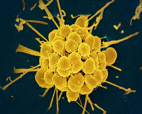 FDA approves first new antibiotics to treat gonorrhea in decades, with hope to combat drug resistance