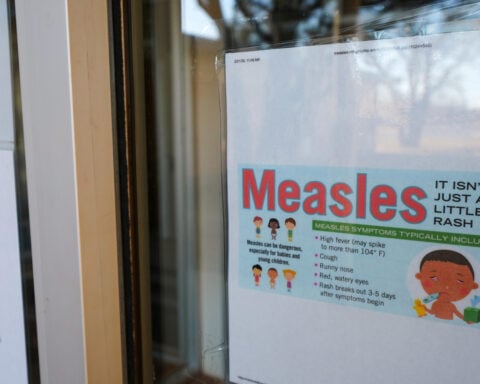 South Carolina measles outbreak grows by nearly 100, spreads to North Carolina and Ohio