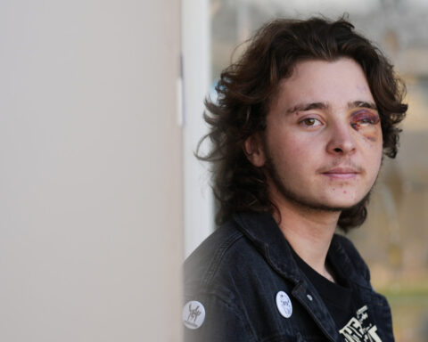 Demonstrator injured after federal agent fired projectile from close range during California protest