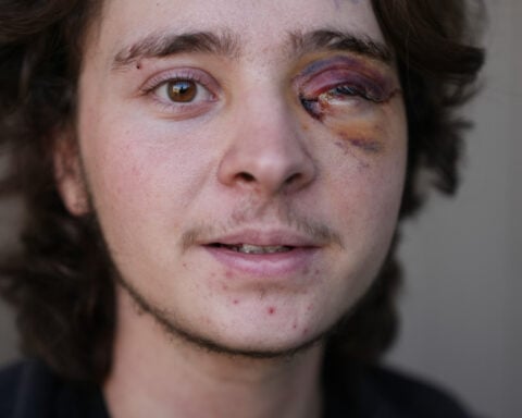 California protester left blind in one eye is among string of violent run-ins with federal agents