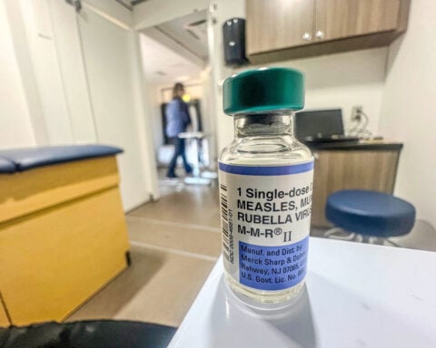 Measles elimination status ‘not really’ a concern, CDC official says