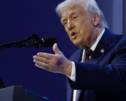 Trump says heavy bruise on his left hand came after he ‘clipped it on the table’