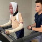 1 year after deadly Northeast Philadelphia plane crash, inside 10-year-old Ramesses' road to recovery